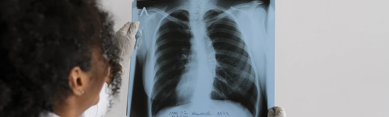 Pneumologista Consulta online